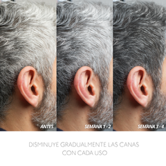 CHAMPÚ COLOR PROGRESIVO PARA CANAS COLOR YA  X  200 ML